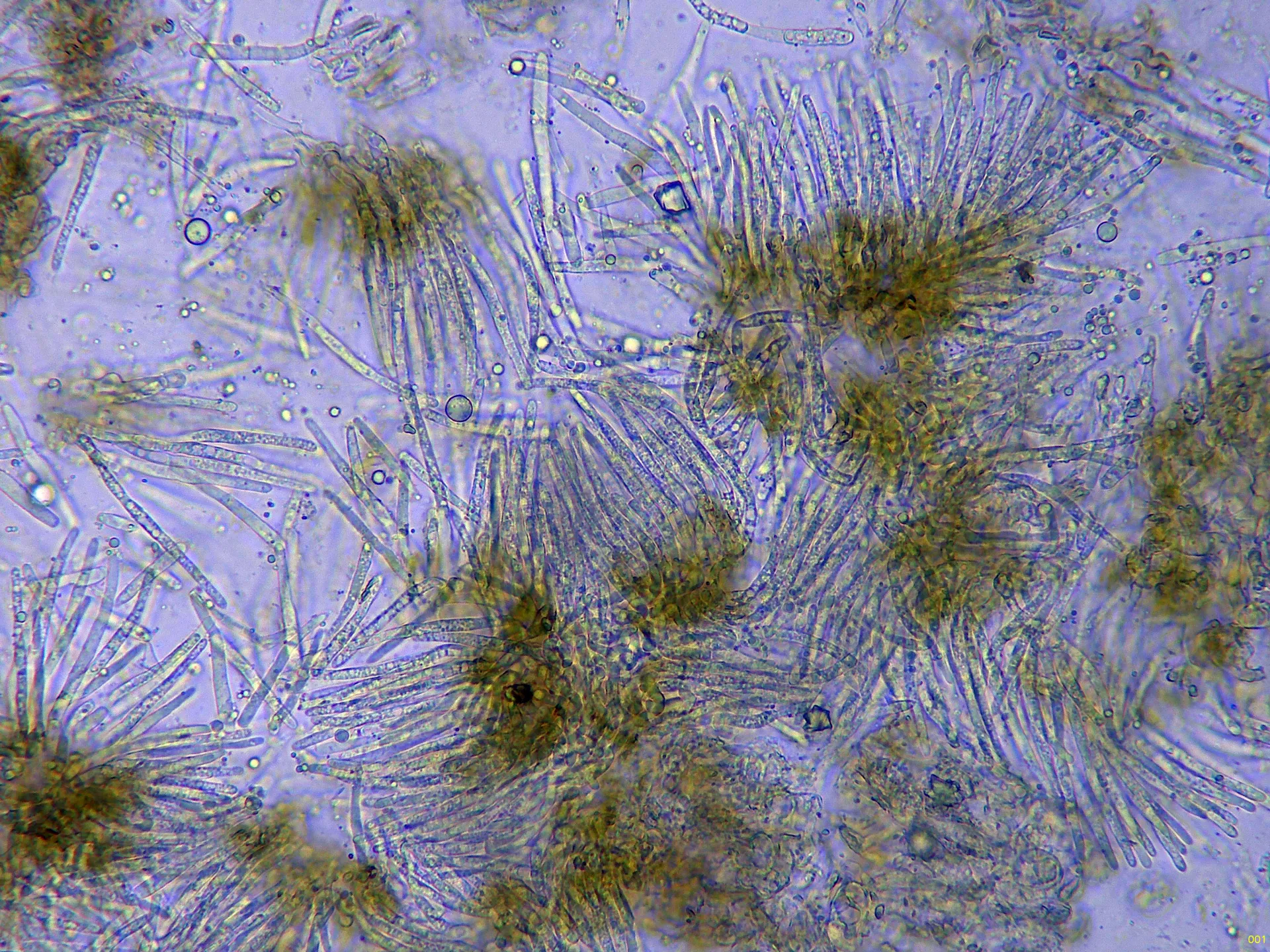 Microscopía de Neophloeospora maculans - 11 - Himenio x 400 agua-001